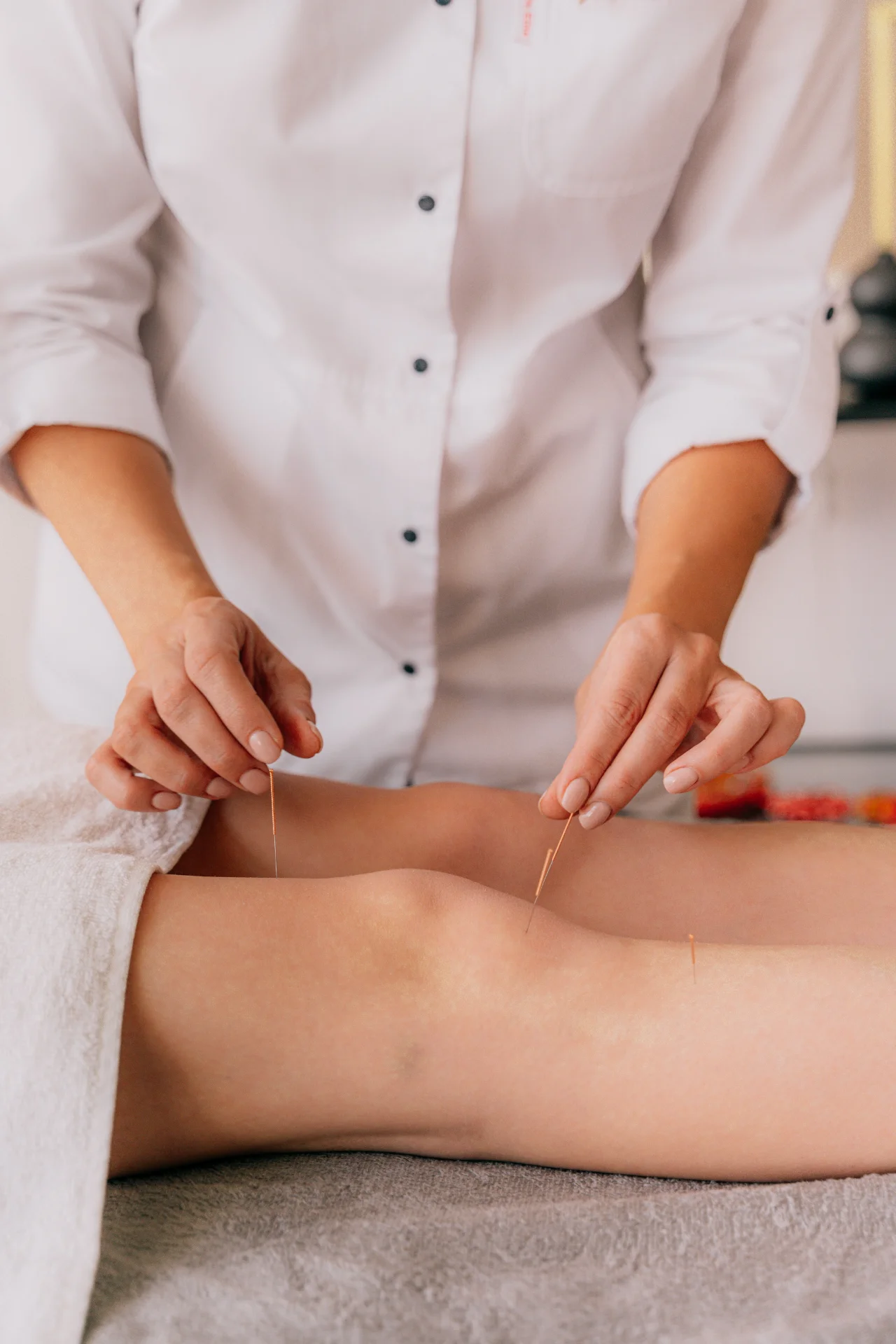 cairns acupuncture & massage cover photo